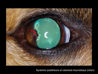 Synéchie postérieure et cataracte traumatique (chien)

 