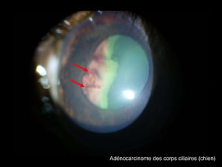 Adénocarcinome des corps ciliaires (chien)

 