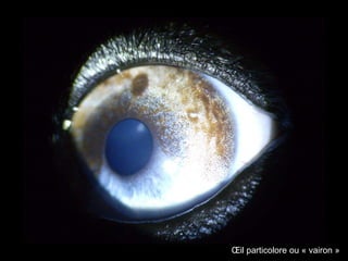 Œil particolore ou « vairon »

 