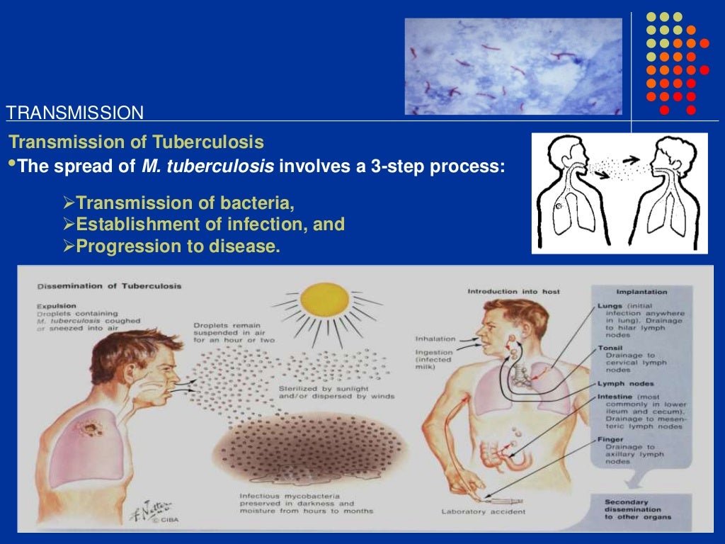IN VITRO STUDY OF A MULTI DRUG RESISTANT MYCOBACTERIA AND EFFECT OF H…