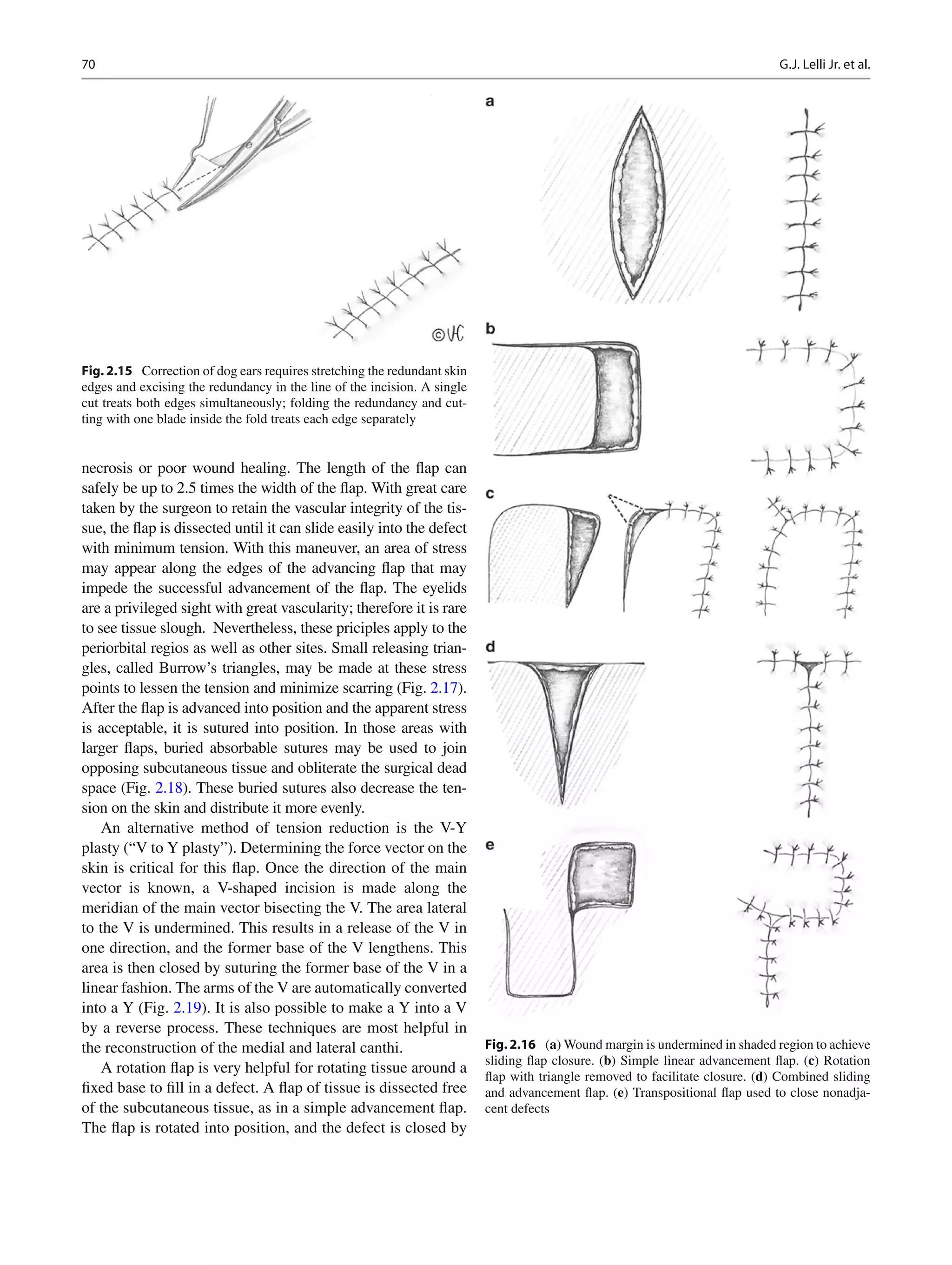 Smith and nesis ophthalmic plastic and reconstructive surgery | PDF