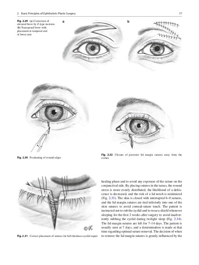 Smith and nesis ophthalmic plastic and reconstructive surgery