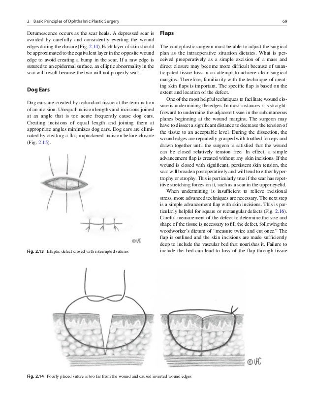 Smith and nesis ophthalmic plastic and reconstructive surgery