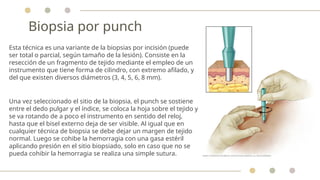 Punch Incision Derma Alveolitis, tipos, quistes inflamatorios | PPTX