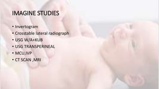 Anorectal malformation | PPTX
