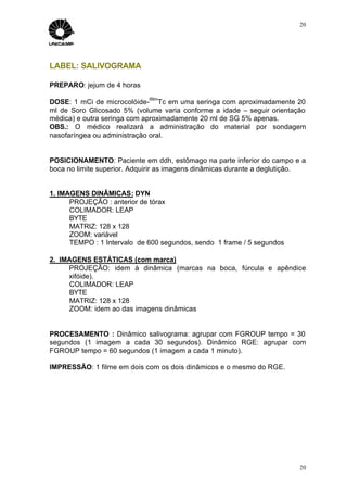 20




LABEL: SALIVOGRAMA

PREPARO: jejum de 4 horas
                             99m
DOSE: 1 mCi de microcolóide- Tc em uma seringa com aproximadamente 20
ml de Soro Glicosado 5% (volume varia conforme a idade – seguir orientação
médica) e outra seringa com aproximadamente 20 ml de SG 5% apenas.
OBS.: O médico realizará a administração do material por sondagem
nasofaríngea ou administração oral.


POSICIONAMENTO: Paciente em ddh, estômago na parte inferior do campo e a
boca no limite superior. Adquirir as imagens dinâmicas durante a deglutição.


1. IMAGENS DINÂMICAS: DYN
      PROJEÇÃO : anterior de tórax
      COLIMADOR: LEAP
      BYTE
      MATRIZ: 128 x 128
      ZOOM: variável
      TEMPO : 1 Intervalo de 600 segundos, sendo 1 frame / 5 segundos

2. IMAGENS ESTÁTICAS (com marca)
     PROJEÇÃO: idem à dinâmica (marcas na boca, fúrcula e apêndice
     xifóide).
     COLIMADOR: LEAP
     BYTE
     MATRIZ: 128 x 128
     ZOOM: idem ao das imagens dinâmicas


PROCESAMENTO : Dinâmico salivograma: agrupar com FGROUP tempo = 30
segundos (1 imagem a cada 30 segundos). Dinâmico RGE: agrupar com
FGROUP tempo = 60 segundos (1 imagem a cada 1 minuto).

IMPRESSÃO: 1 filme em dois com os dois dinâmicos e o mesmo do RGE.




                                                                          20
 