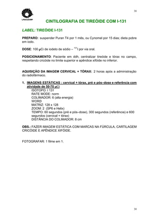 30



               CINTILOGRAFIA DE TIREÓIDE COM I-131

LABEL: TIREÓIDE I-131

PREPARO: suspender Puran T4 por 1 mês, ou Cynomel por 15 dias; dieta pobre
em iodo.

DOSE: 100 µCi de iodeto de sódio –
                                     131
                                           I por via oral.

POSICIONAMENTO: Paciente em ddh, centralizar tireóide e tórax no campo,
respeitando cricóide no limite superior e apêndice xifóide no inferior.


AQUISIÇÃO DA IMAGEM CERVICAL + TÓRAX: 2 horas após a administração
do radiofármaco.

1. IMAGENS ESTÁTICAS : cervical + tórax, pré e pós–dose e referência com
   atividade de 50-70 µCi
       ISÓTOPO: I 131
       RATE MODE: norm
       COLIMADOR: 6 (alta energia)
       WORD
       MATRIZ: 128 x 128
       ZOOM: 2 (SP6 e Helix)
       TEMPO: 60 segundos (pré e pós–dose), 300 segundos (referência) e 600
       segundos (cervical + tórax)
       DISTÂNCIA DO COLIMADOR: 8 cm

OBS.: FAZER IMAGEM ESTÁTICA COM MARCAS NA FÚRCULA, CARTILAGEM
CRICÓIDE E APÊNDICE XIFÓIDE.


FOTOGRAFAR: 1 filme em 1.




                                                                         30
 