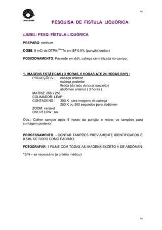 46



                   PESQUISA DE FíSTULA LIQUÓRICA

LABEL: PESQ. FÍSTULA LIQUÓRICA

PREPARO: nenhum
                       99m
DOSE: 5 mCi de DTPA-      Tc em SF 0,9% (punção lombar)

POSICIONAMENTO: Paciente em ddh, cabeça centralizada no campo.



1. IMAGENS ESTÁTICAS ( 3 HORAS, 6 HORAS ATE 24 HORAS S/N*) :
      PROJEÇÕES :      cabeça anterior
                       cabeça posterior
                       fletida (do lado do local suspeito)
                       abdômen anterior ( 3 horas )
      MATRIZ: 256 x 256
      COLIMADOR: LEAP
      CONTAGENS :      300 K para imagens de cabeça
                       200 K ou 300 segundos para abdômen
      ZOOM: variável
      OVERFLOW : no

Obs.: Colher sangue após 6 horas da punção e retirar os tampões para
contagem posterior.


PROCESSAMENTO: - CONTAR TAMPÕES PREVIAMENTE IDENTIFICADOS E
0,5ML DE SORO COMO PADRÃO.

FOTOGRAFAR: 1 FILME COM TODAS AS IMAGENS EXCETO A DE ABDÔMEN.

*S/N – se necessário (a critério médico)




                                                                  46
 