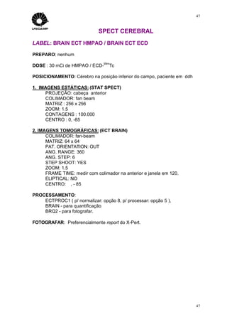 47



                              SPECT CEREBRAL
LABEL: BRAIN ECT HMPAO / BRAIN ECT ECD

PREPARO: nenhum
                                99m
DOSE : 30 mCi de HMPAO / ECD-     Tc

POSICIONAMENTO: Cérebro na posição inferior do campo, paciente em ddh

1. IMAGENS ESTÁTICAS: (STAT SPECT)
     PROJEÇÃO: cabeça anterior
     COLIMADOR: fan beam
     MATRIZ : 256 x 256
     ZOOM: 1.5
     CONTAGENS : 100.000
     CENTRO : 0, -85

2. IMAGENS TOMOGRÁFICAS: (ECT BRAIN)
      COLIMADOR: fan-beam
      MATRIZ: 64 x 64
      PAT. ORIENTATION: OUT
      ANG. RANGE: 360
      ANG. STEP: 6
      STEP SHOOT: YES
      ZOOM: 1.5
      FRAME TIME: medir com colimador na anterior e janela em 120.
      ELIPTICAL: NO
      CENTRO: ∅, - 85

PROCESSAMENTO:
    ECTPROC1 ( p/ normalizar: opção 8, p/ processar: opção 5 ),
    BRAIN - para quantificação
    BRQ2 - para fotografar.

FOTOGRAFAR: Preferencialmente report do X-Pert.




                                                                        47
 
