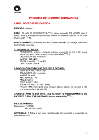 6




               PESQUISA DE NECROSE MIOCÁRDICA
LABEL: NECROSE MIOCÁRDICA

PREPARO: nenhum
                                   99m
DOSE: 15 mCi DE PIROFOSFATO- Tc. Iniciar aquisição NO MÍNIMO após 3
horas. Após a aquisição de pirofosfato, injetar, na mesma posição: 15 mCi de
            99m
SESTAMIBI -    Tc.

POSICIONAMENTO: Paciente em ddh, braços embaixo da cabeça, miocárdio
centralizado no campo.

1. IMAGENS ESTÁTICAS:
     PROJEÇÕES: anterior, oblíquas anterior esquerda de 30 e 60 graus,
                                                       99m
     lateral esquerda (feitas apenas com o pirofosfato- Tc)
     COLIMADOR: alta resolução
     MATRIZ : 256 x 256
     ZOOM: 1 na SP4, 1.3 na SP6
     CONTAGENS : 500 K

2. IMAGENS TOMOGRÁFICAS ECT PIRO E ECT MIBI :
      VIEW: ECT PIRO / ECT MIBI
      COLIMADOR: alta resolução
      MATRIZ: 64 x 64
      ANG. RANGE: 186
      ANG. STEP: 6
      STEP SHOOT: YES
      ZOOM: 1 (SP4) , 1.3 (SP6 / Helix)
      FRAME TIME: medir pela OAE 45 graus (deixar saturar no coração, e não
      nos arcos costais), janela 100.

ATENÇÃO: APÓS O ECT PIRO, NÃO ALTERAR O POSICIONAMENTO DO
                                                  99m
PACIENTE E REALIZAR O ECT-MIBI (injetar sestamibi— Tc).


PROCESSAMENTO:
Nas gamas: TLPROC
           Ou no Xpert mach.

IMPRESSÃO: 1 folha o All slice, identificando corretamente a aquisição de
pirofosfato e mibi.




                                                                           6
 