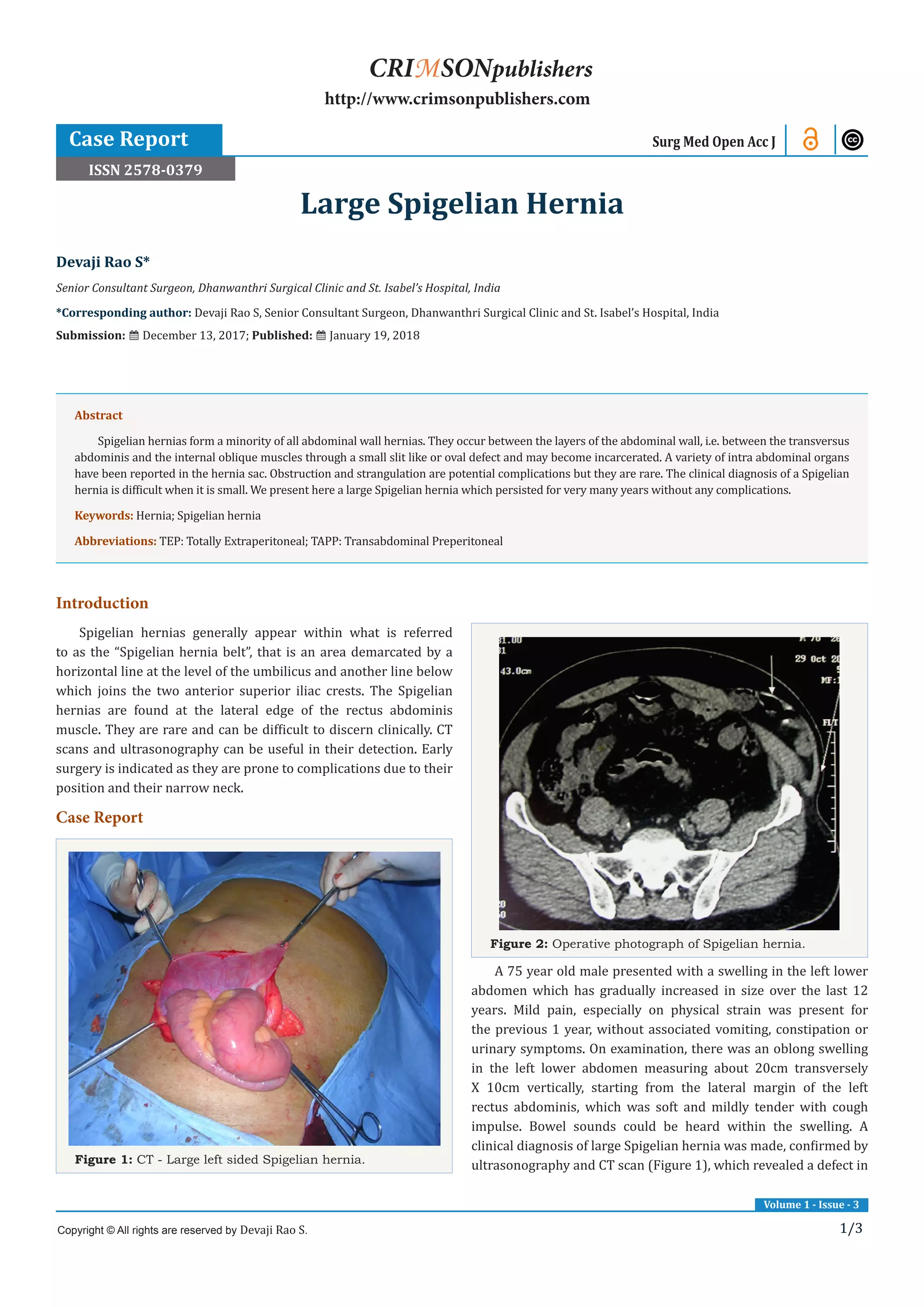 Large Spigelian Hernia PDF