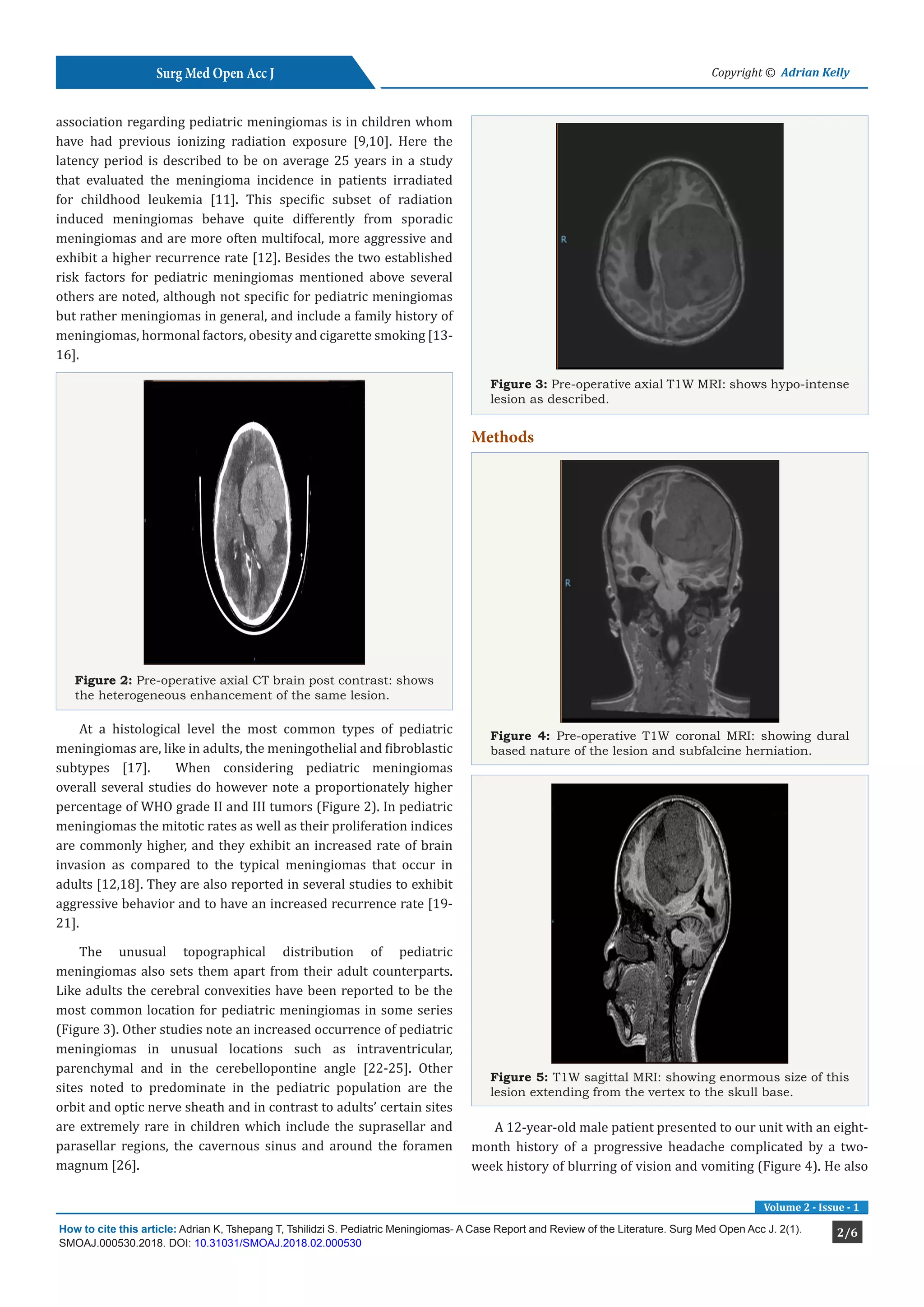 Pediatric Meningiomas- A Case Report and Review of the Literature ...