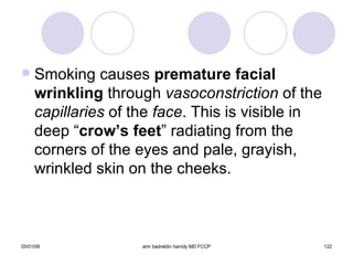 Smoking causes  premature facial wrinkling  through  vasoconstriction  of the  capillaries  of the  face . This is visible in deep “ crow’s   feet ” radiating from the corners of the eyes and pale, grayish, wrinkled skin on the cheeks. 
