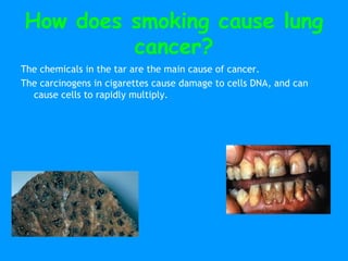 Smoking & Cancer PPT | PPT
