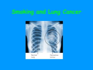 Smoking and Lung Cancer 