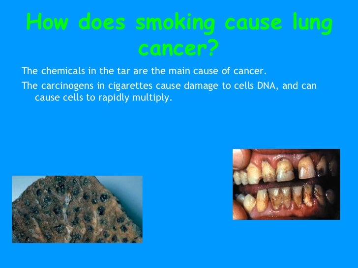 Somking cancer