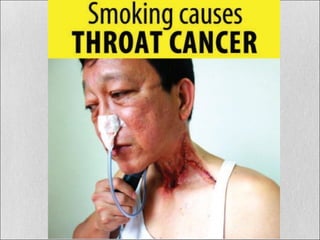 Smoking and drinking are bad for your health by roel tolentino