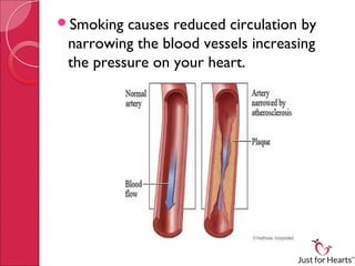 Smoking and heart health | PPT