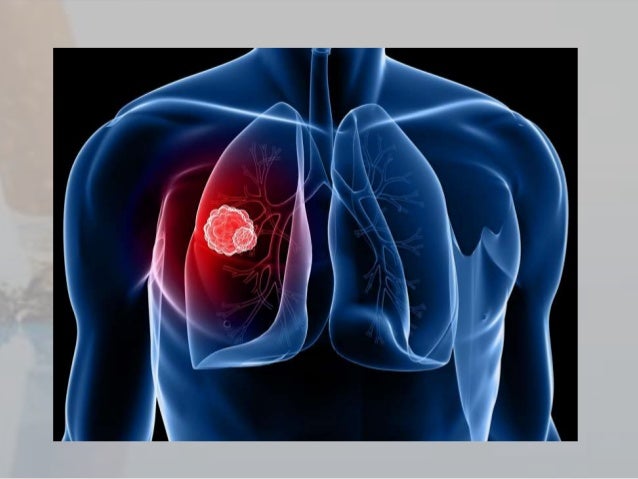 why tobacco is major cause for lung cancer?
