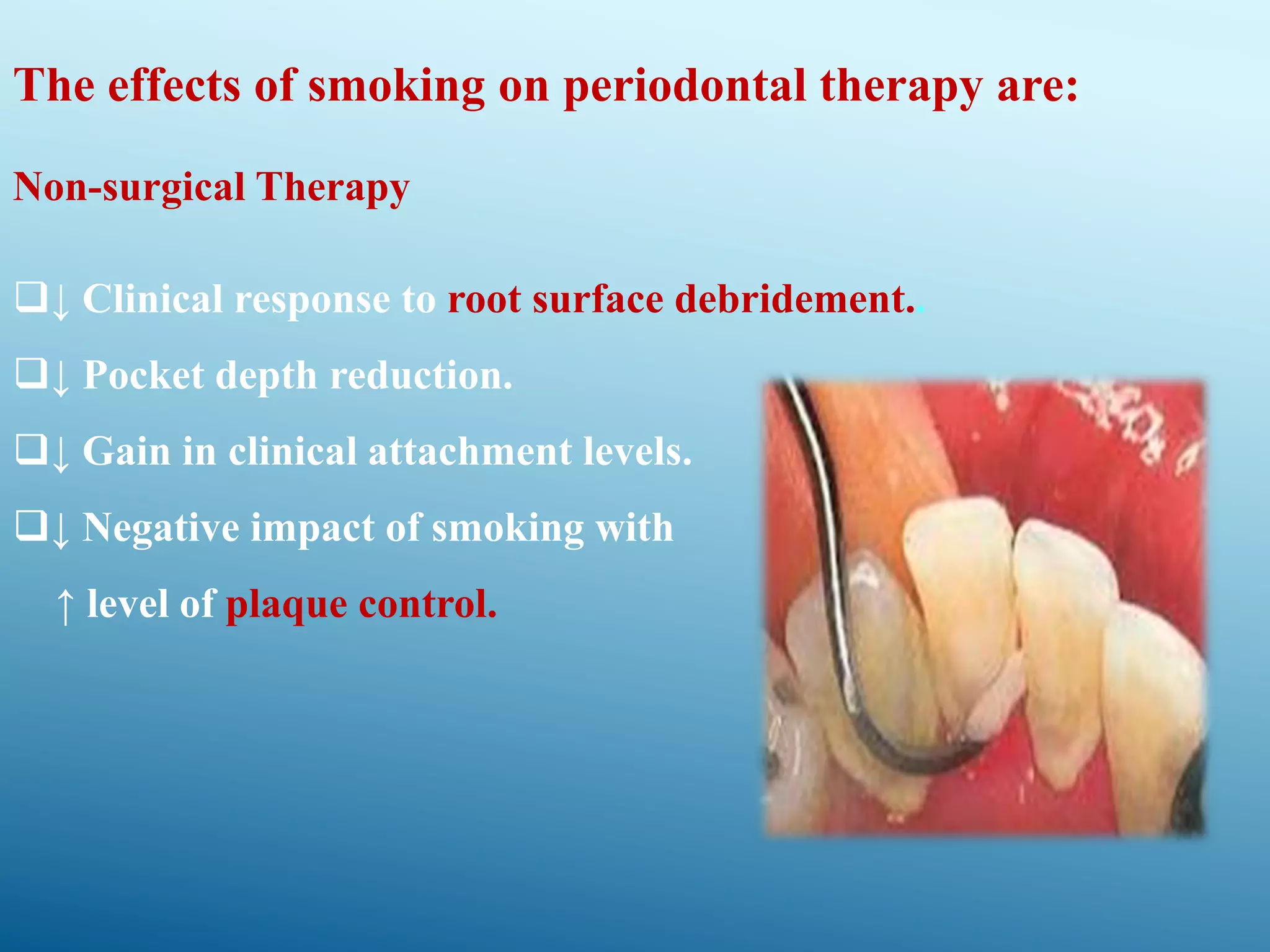 Smoking and periodontal disease PPT