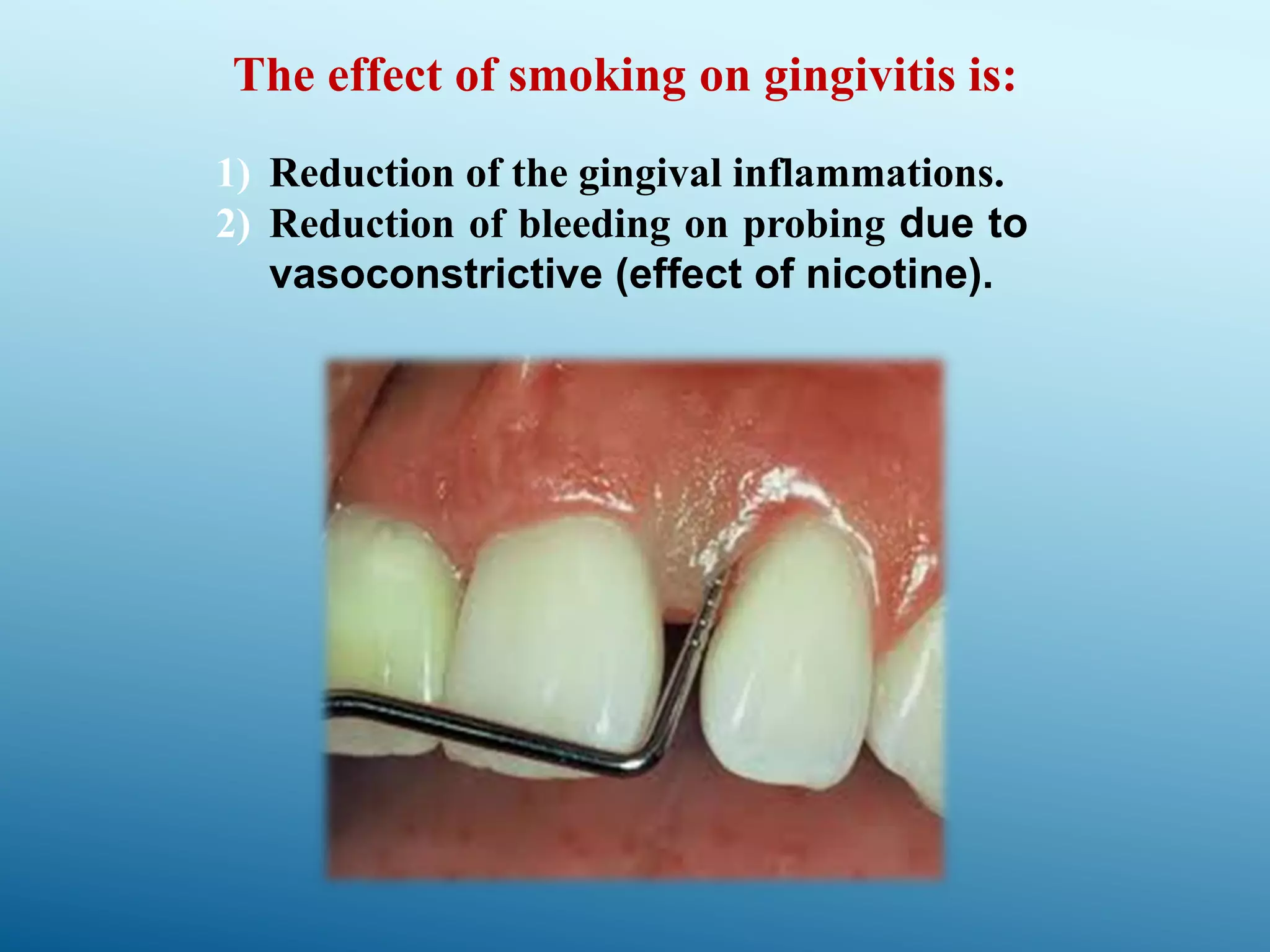 Smoking and periodontal disease PPT