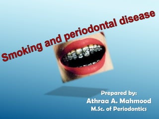 Prepared by:
Athraa A. Mahmood
M.Sc. of Periodontics
 