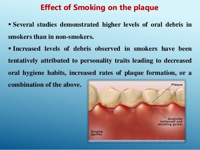 Smoking and periodontal disease