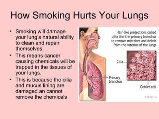 How Smoking Hurts Your Lungs
• Smoking will damage
your lung’s natural ability
to clean and repair
themselves.
• This means cancer
causing chemicals will be
trapped in the tissues of
your lungs.
• This is because the cilia
and mucus lining are
damaged an cannot
remove the chemicals
 