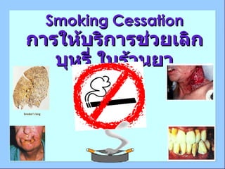 Smoking Cessation การให้บริการช่วยเลิกบุหรี่ ในร้านยา 