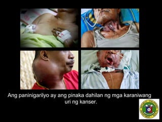 Ang paninigarilyo ay ang pinaka dahilan ng mga karaniwang
uri ng kanser.
 