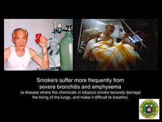 Smokers suffer more frequently from
severe bronchitis and emphysema
(a disease where the chemicals in tobacco smoke severely damage
the lining of the lungs, and make it difficult to breathe).
 