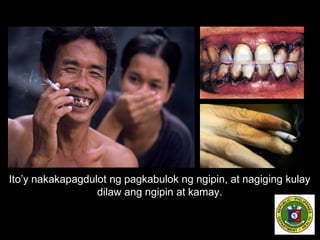 Ito’y nakakapagdulot ng pagkabulok ng ngipin, at nagiging kulay
dilaw ang ngipin at kamay.
 