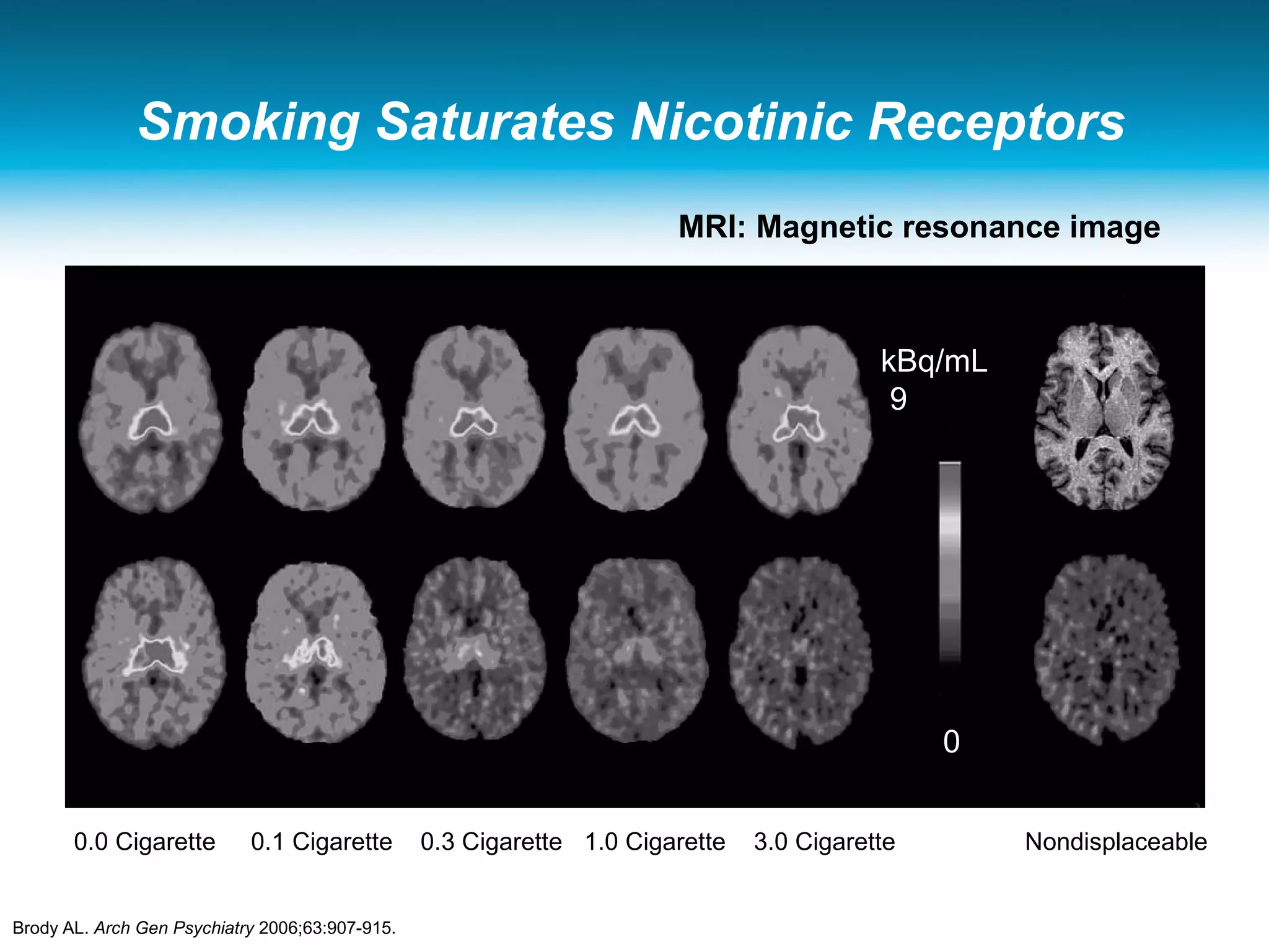 Smoking Saturates Nicotinic Receptors
0.0 Cigarette 0.1 Cigarette 0.3 Cigarette 1.0 Cigarette 3.0 Cigarette Nondisplaceable
MRI: Magnetic resonance image
kBq/mL
9
0
Brody AL. Arch Gen Psychiatry 2006;63:907-915.
 