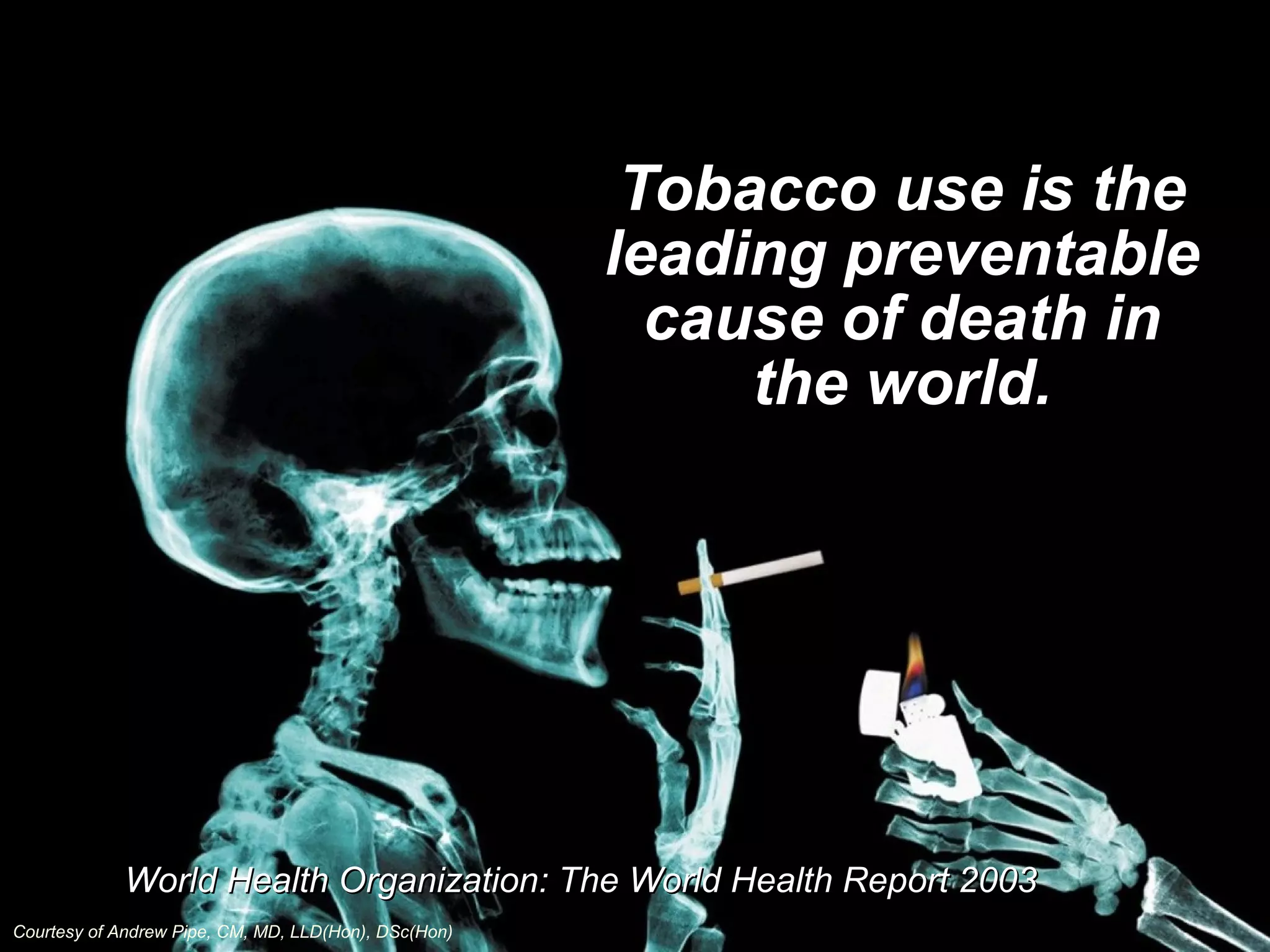 Tobacco use is theTobacco use is the
leading preventableleading preventable
cause of death incause of death in
the world.the world.
World Health Organization: The World Health Report 2003World Health Organization: The World Health Report 2003
Courtesy of Andrew Pipe, CM, MD, LLD(Hon), DSc(Hon)
 