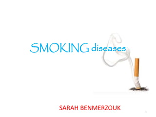 SMOKING diseases
SARAH BENMERZOUK 1
 