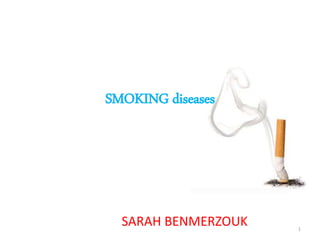 SMOKING diseases
SARAH BENMERZOUK 1
 