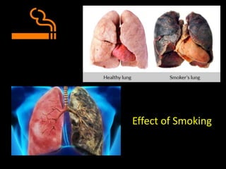 Effect of Smoking
 