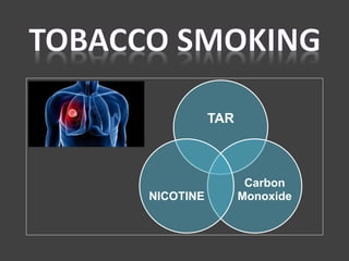 TAR
Carbon
MonoxideNICOTINE
 