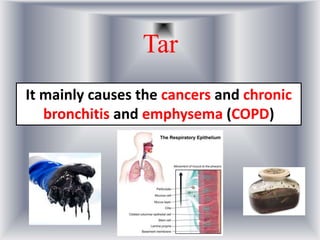 Tar
It mainly causes the cancers and chronic
bronchitis and emphysema (COPD)
 
