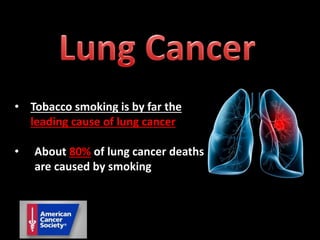 • Tobacco smoking is by far the
leading cause of lung cancer
• About 80% of lung cancer deaths
are caused by smoking
 