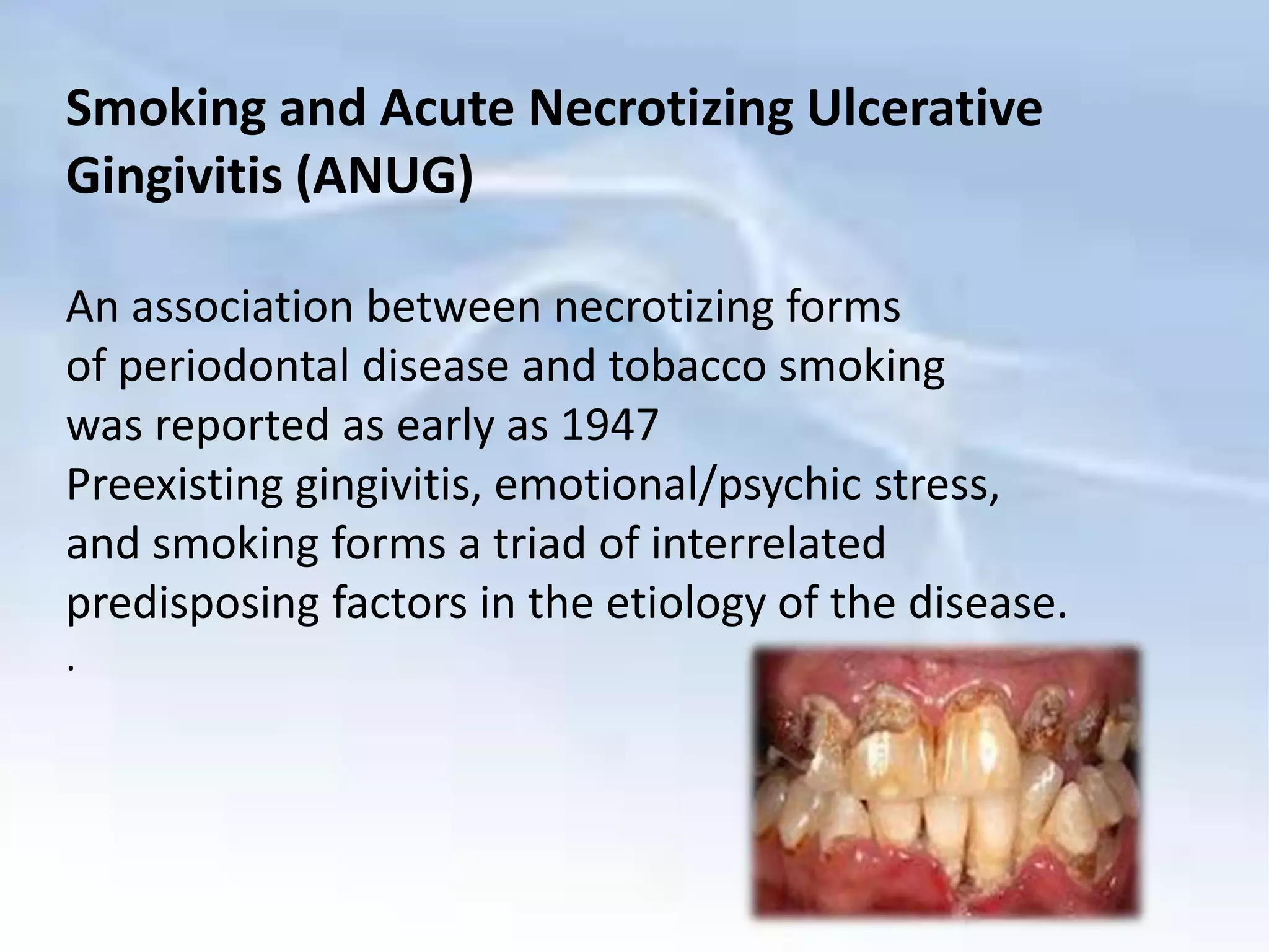 Smoking & periodontium | PPTX