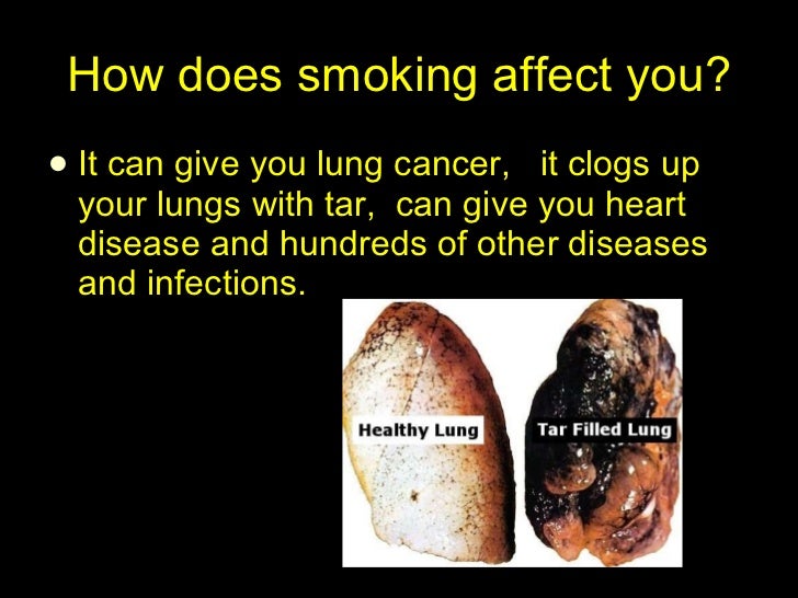 Smoking powerpoint