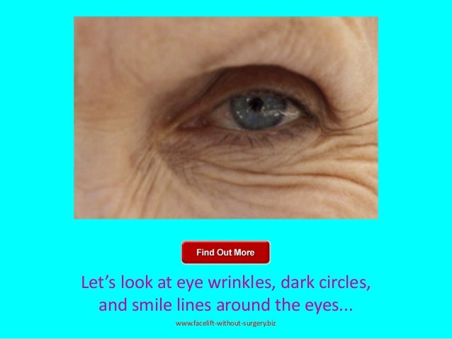 Exercises For Crows Feet