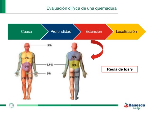 Curso de Primeros Auxilios: quemaduras