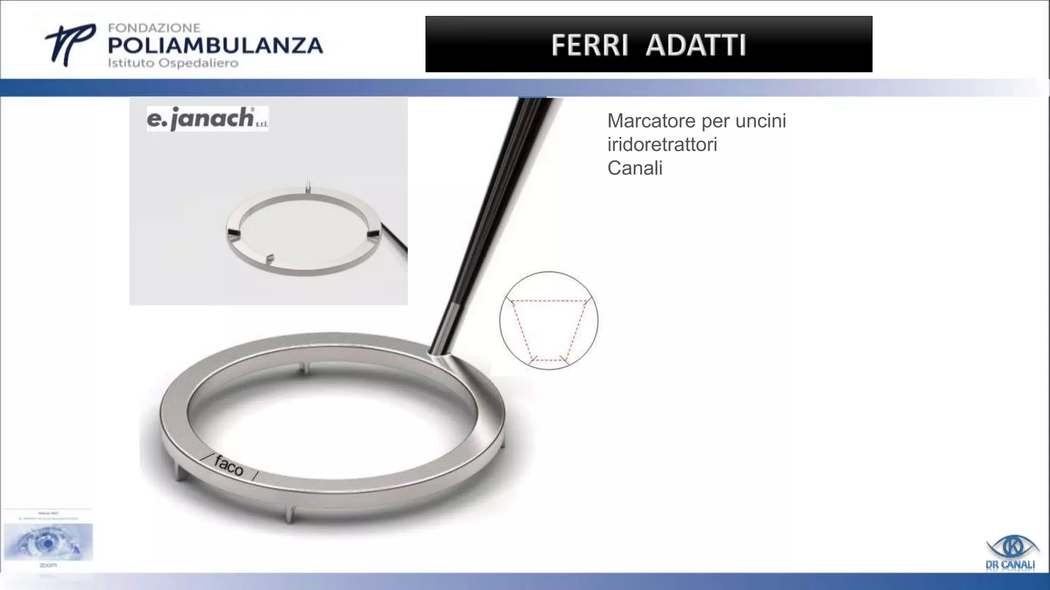 Marcatore per uncini
iridoretrattori
Canali