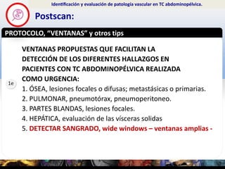 PROTOCOLO, “VENTANAS” y otros tips
Example text
Postscan:
Identificación y evaluación de patología vascular en TC abdom...
