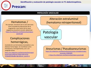 SIGNOLOGÍA
Prescan:
Identificación y evaluación de patología vascular en TC abdominopélvica.
PATOLOGÍA VASCULAR
Exampl...