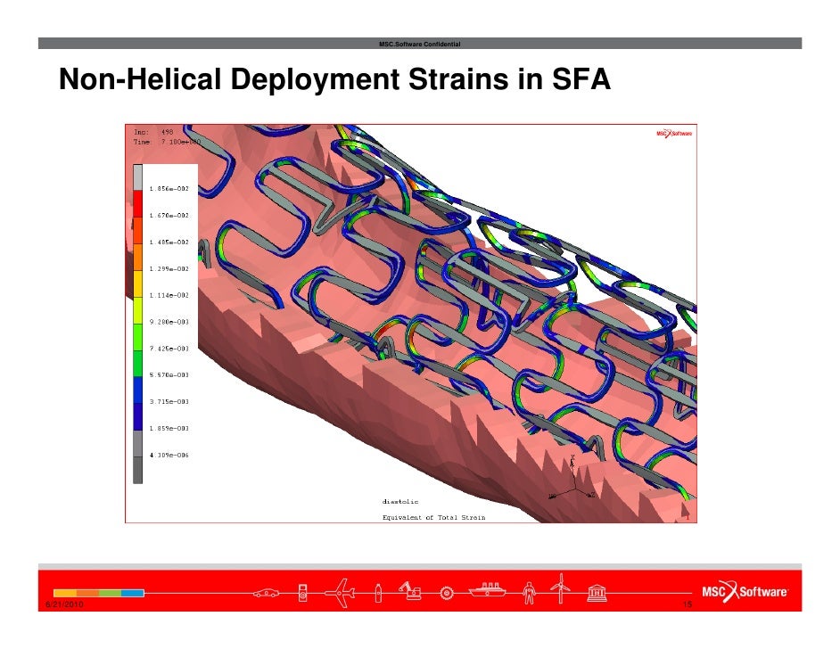 Stent Numerical Simulations presented at SMST 2010 conference