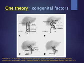 One theory : congenital factors
Sfyroeras, G., et al. (2009). "Visceral venous aneurysms: clinical presentation, natural history and their
management: a systematic review." European Journal of Vascular and Endovascular Surgery 38(4): 498-505.
 