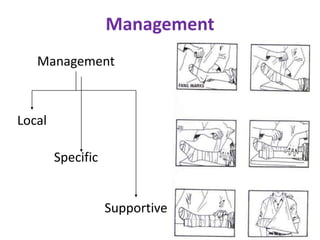 Management
Management
Local
Specific
Supportive
 